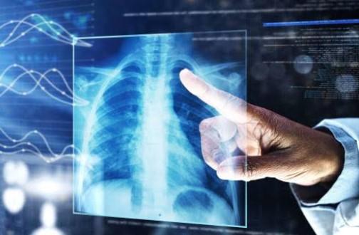 J&K to Receive 275 AI-Enabled Handheld X-Ray Machines, 9 MRI Units and 4 Mammography Units under Prime Minister's Fund
